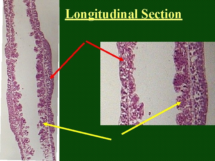 Longitudinal Section 