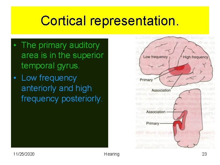 Cortical representation. • The primary auditory area is in the superior temporal gyrus. •