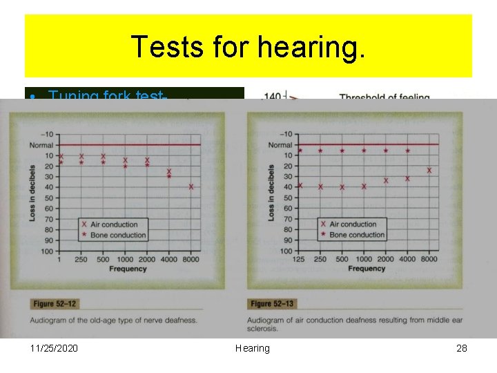 Tests for hearing. • Tuning fork test • Weber test- tuning fork at vertex.