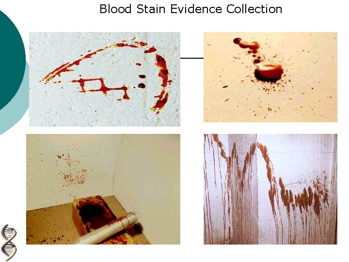 Blood Stain Evidence Collection 