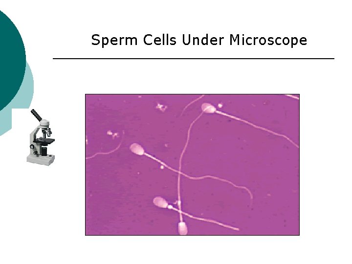 Identification of Semen Sperm Cells Under Microscope 