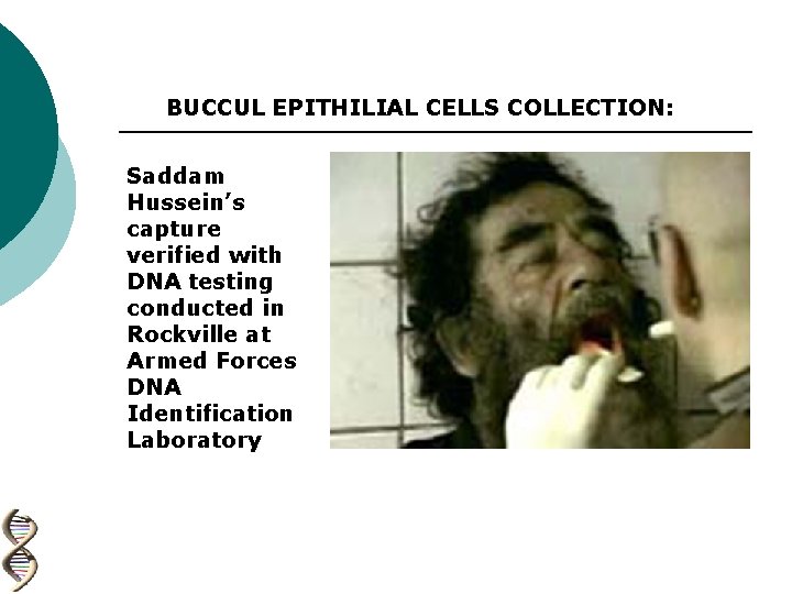 BUCCUL EPITHILIAL CELLS COLLECTION: Saddam Hussein’s capture verified with DNA testing conducted in Rockville