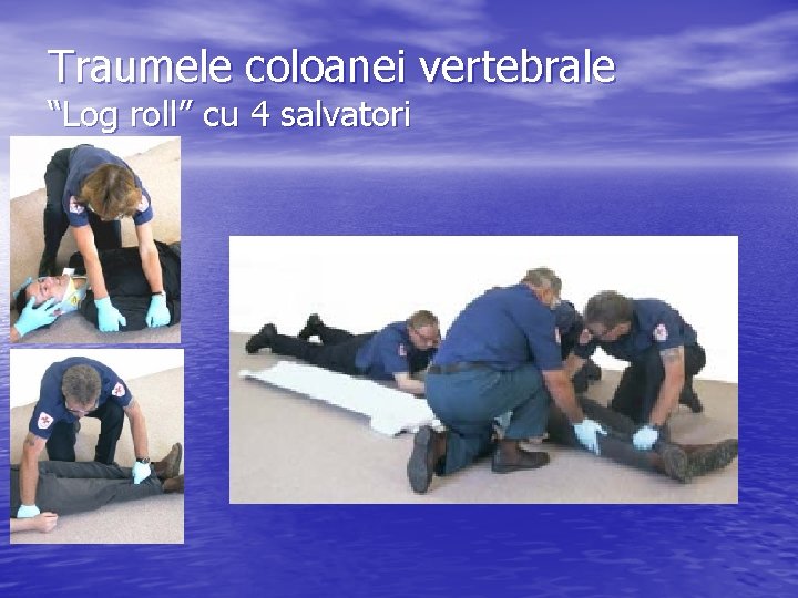 Traumele coloanei vertebrale “Log roll” cu 4 salvatori 
