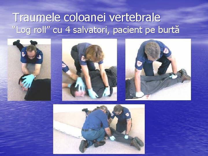 Traumele coloanei vertebrale “Log roll” cu 4 salvatori, pacient pe burtă 