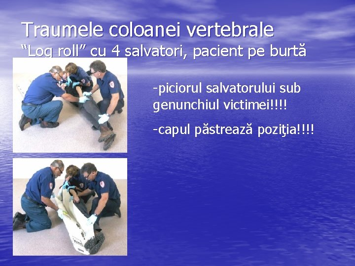 Traumele coloanei vertebrale “Log roll” cu 4 salvatori, pacient pe burtă -piciorul salvatorului sub