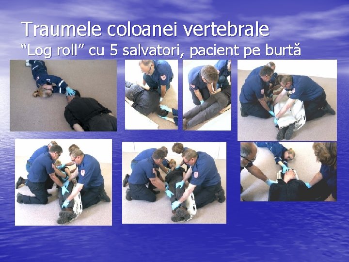 Traumele coloanei vertebrale “Log roll” cu 5 salvatori, pacient pe burtă 