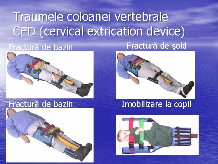 Traumele coloanei vertebrale CED (cervical extrication device) Fractură de bazin Fractură de şold Fractură