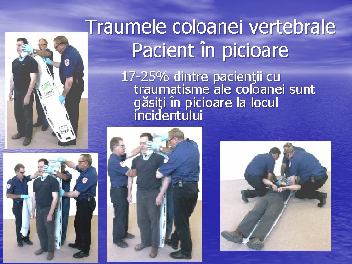 Traumele coloanei vertebrale Pacient în picioare 17 -25% dintre pacienţii cu traumatisme ale coloanei