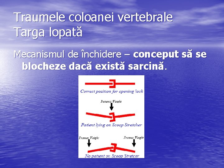 Traumele coloanei vertebrale Targa lopată Mecanismul de închidere – conceput să se blocheze dacă