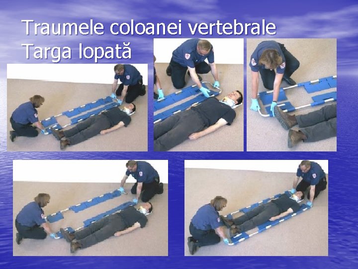 Traumele coloanei vertebrale Targa lopată 