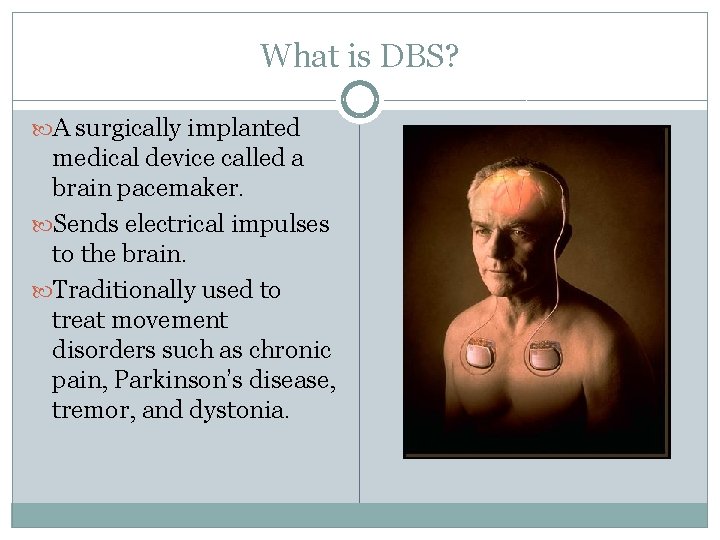 What is DBS? A surgically implanted medical device called a brain pacemaker. Sends electrical