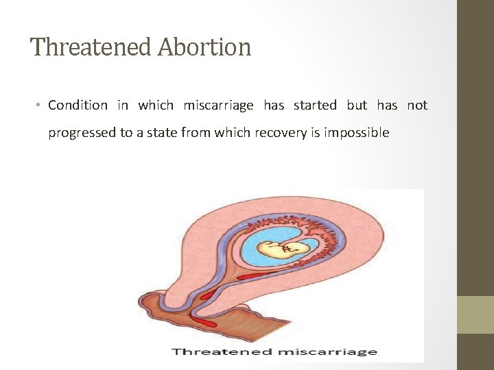 Threatened Abortion • Condition in which miscarriage has started but has not progressed to