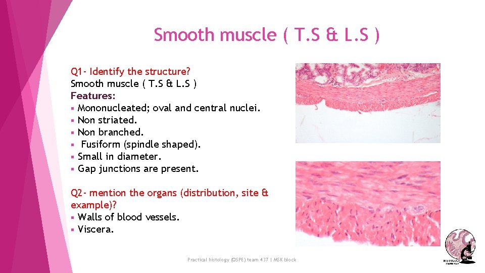 Smooth muscle ( T. S & L. S ) Q 1 - Identify the