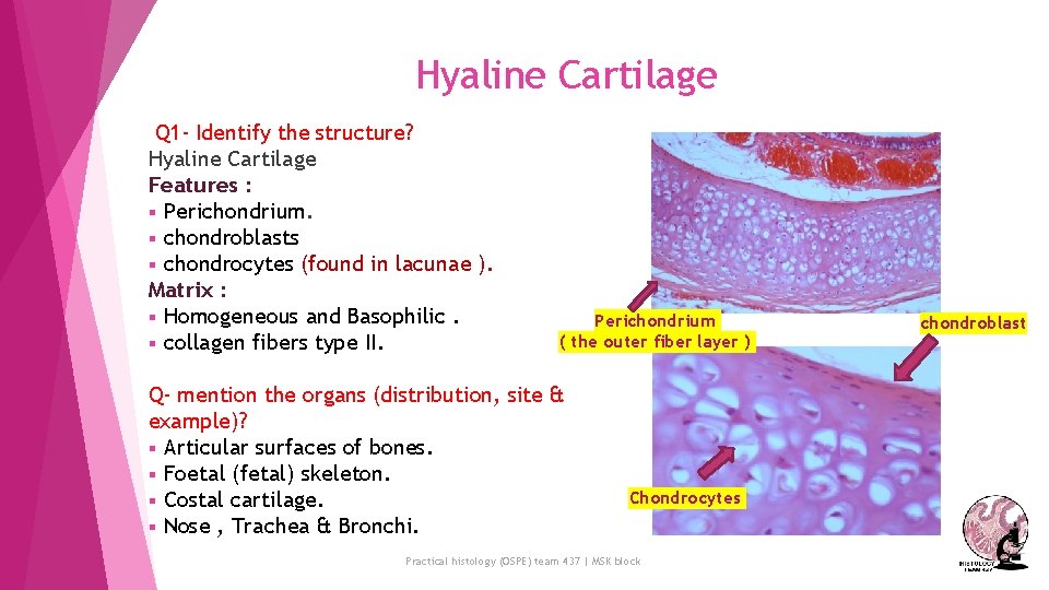 Hyaline Cartilage Q 1 - Identify the structure? Hyaline Cartilage Features : § Perichondrium.