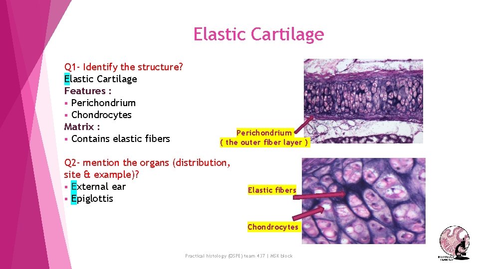 Elastic Cartilage Q 1 - Identify the structure? Elastic Cartilage Features : § Perichondrium