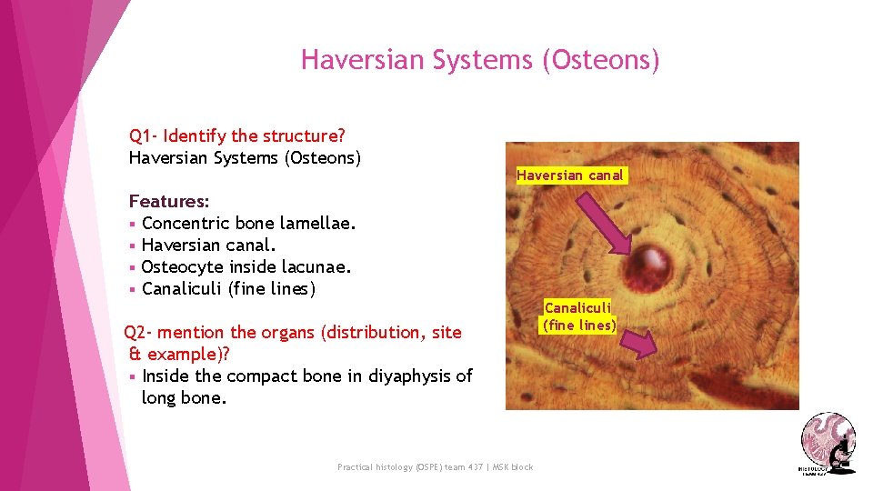 Haversian Systems (Osteons) Q 1 - Identify the structure? Haversian Systems (Osteons) Haversian canal