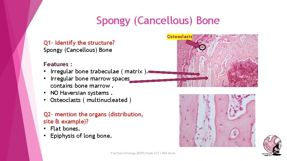 Spongy (Cancellous) Bone Q 1 - Identify the structure? Spongy (Cancellous) Bone Osteoclasts Features