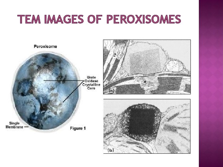 TEM IMAGES OF PEROXISOMES 