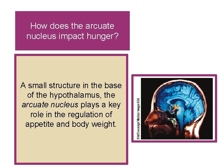 How does the arcuate nucleus impact hunger? A small structure in the base of How does the arcuate nucleus impact hunger? A small structure in the base of