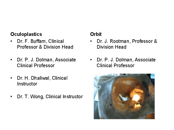 Oculoplastics • Dr. F. Buffam, Clinical Professor & Division Head Orbit • Dr. J.