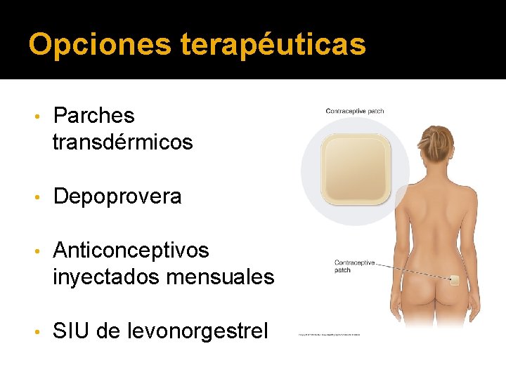 Opciones terapéuticas • Parches transdérmicos • Depoprovera • Anticonceptivos inyectados mensuales • SIU de