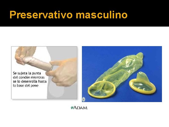 Preservativo masculino 