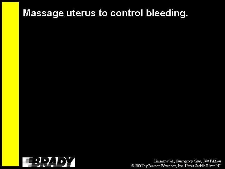 Massage uterus to control bleeding. Limmer et al. , Emergency Care, 10 th Edition