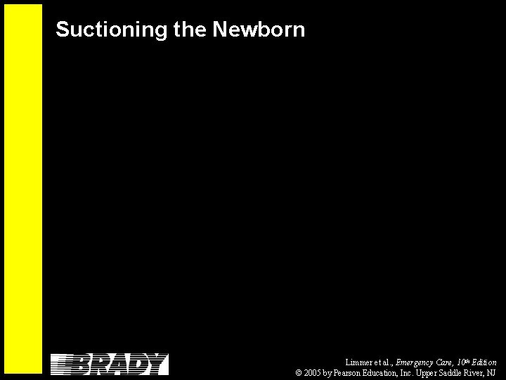 Suctioning the Newborn Limmer et al. , Emergency Care, 10 th Edition © 2005