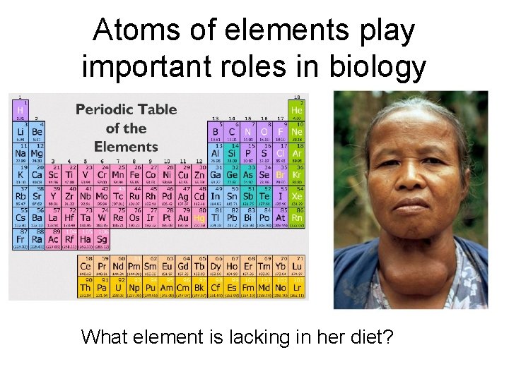 Atoms of elements play important roles in biology What element is lacking in her