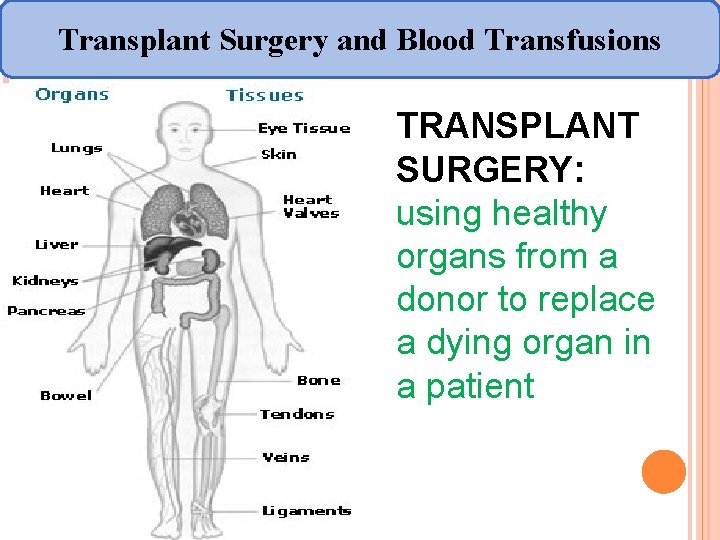 Transplant Surgery and Blood Transfusions TRANSPLANT SURGERY: using healthy organs from a donor to