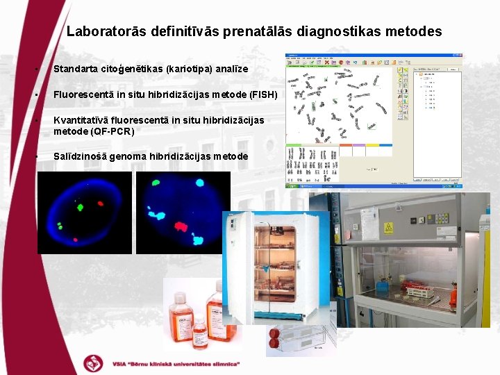 Laboratorās definitīvās prenatālās diagnostikas metodes • Standarta citoģenētikas (kariotipa) analīze • Fluorescentā in situ