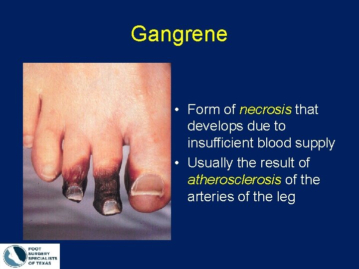 Gangrene • Form of necrosis that develops due to insufficient blood supply • Usually