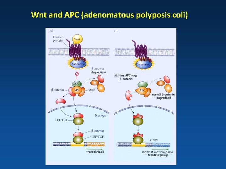 Wnt and APC (adenomatous polyposis coli) 