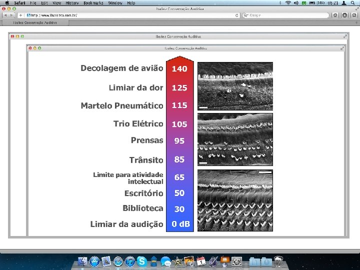 Diagnóstico das Perdas auditivas relacionadas ao trabalho: - exposição consistente ao agente - evolução