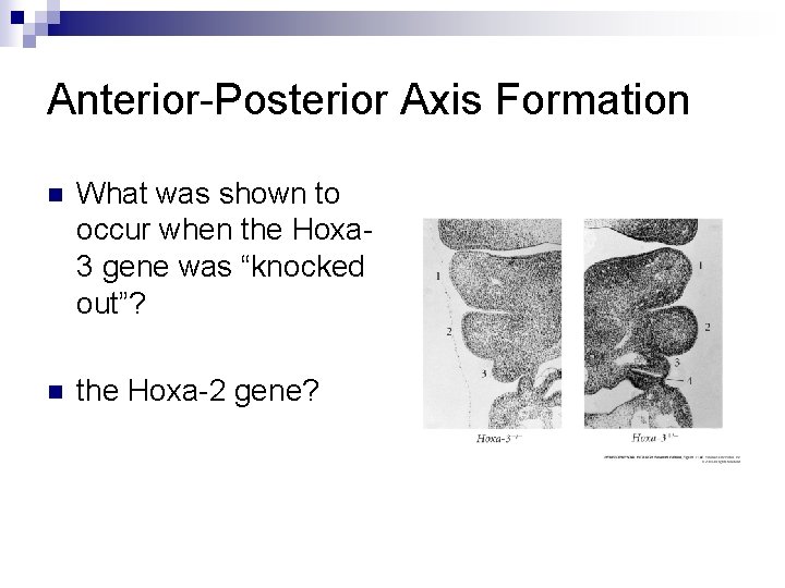 Anterior-Posterior Axis Formation n What was shown to occur when the Hoxa 3 gene Anterior-Posterior Axis Formation n What was shown to occur when the Hoxa 3 gene