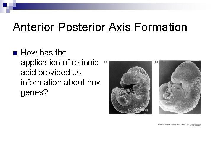 Anterior-Posterior Axis Formation n How has the application of retinoic acid provided us information Anterior-Posterior Axis Formation n How has the application of retinoic acid provided us information