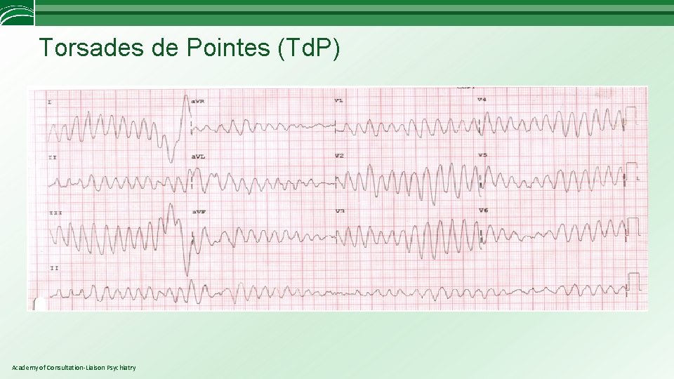 Torsades de Pointes (Td. P) Academy of Consultation-Liaison Psychiatry 