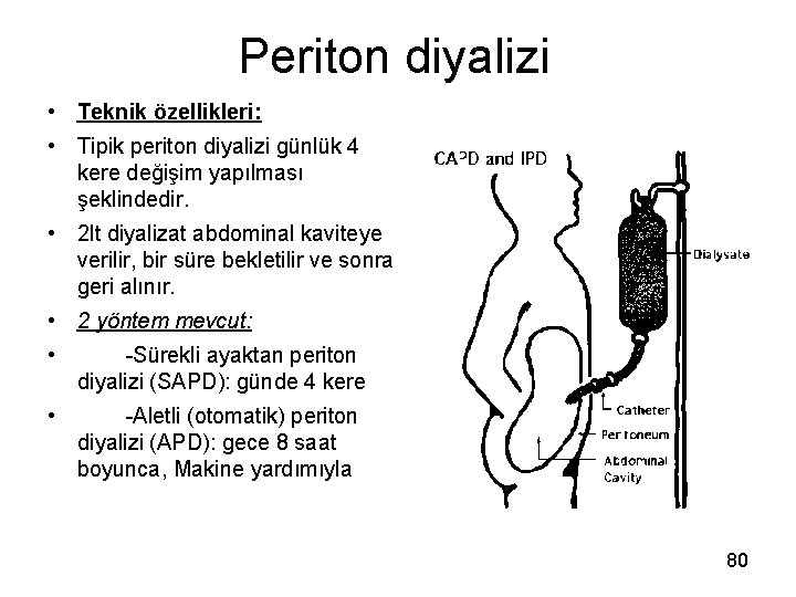 Periton diyalizi • Teknik özellikleri: • Tipik periton diyalizi günlük 4 kere değişim yapılması