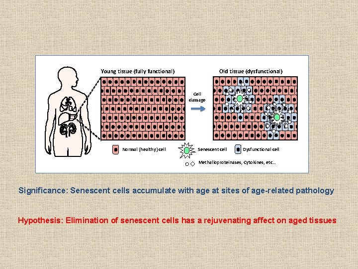 Young tissue (fully functional) Old tissue (dysfunctional) Cell damage Normal (healthy) cell Senescent cell