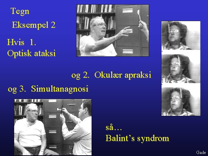 Tegn Eksempel 2 Hvis 1. Optisk ataksi og 2. Okulær apraksi og 3. Simultanagnosi