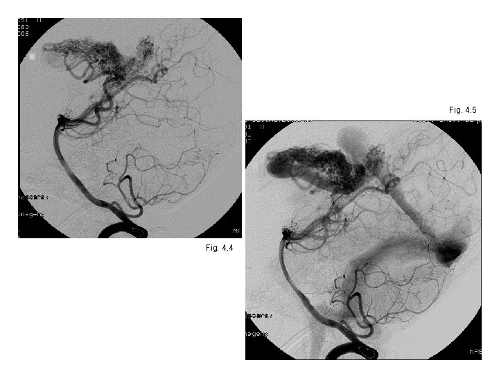 Fig. 4. 5 Fig. 4. 4 