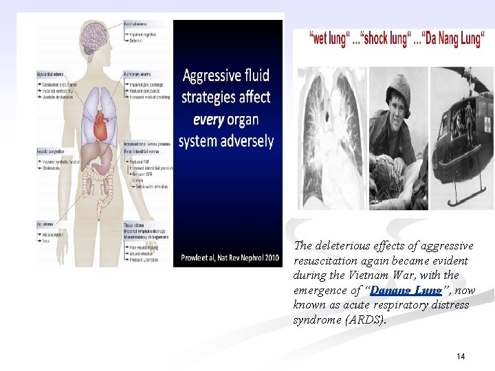 The deleterious effects of aggressive resuscitation again became evident during the Vietnam War, with