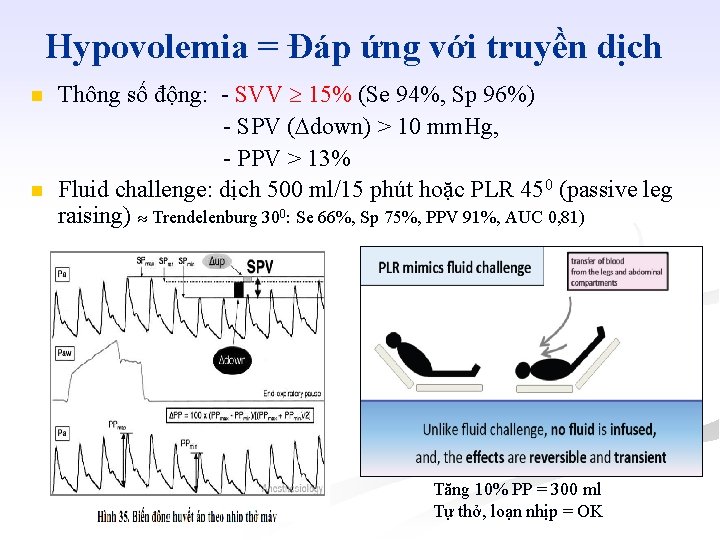 Hypovolemia = Đáp ứng với truyền dịch n n Thông số động: - SVV