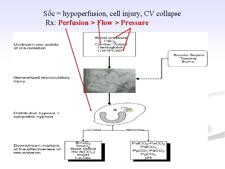 Sốc = hypoperfusion, cell injury, CV collapse Rx: Perfusion > Flow > Pressure 