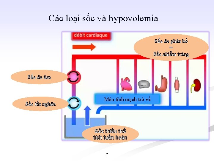 Các loại sốc và hypovolemia Sốc do phân bố = Sốc nhiễm trùng Sốc