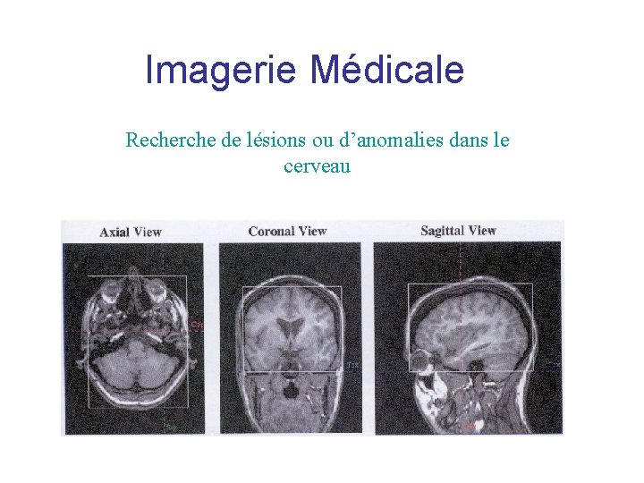 Imagerie Médicale Recherche de lésions ou d’anomalies dans le cerveau Imagerie Médicale Recherche de lésions ou d’anomalies dans le cerveau