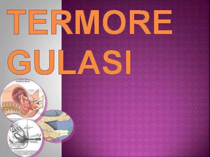 TERMORE GULASI 