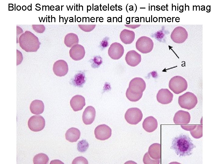 Blood Smear with platelets (a) – inset high mag with hyalomere and granulomere 