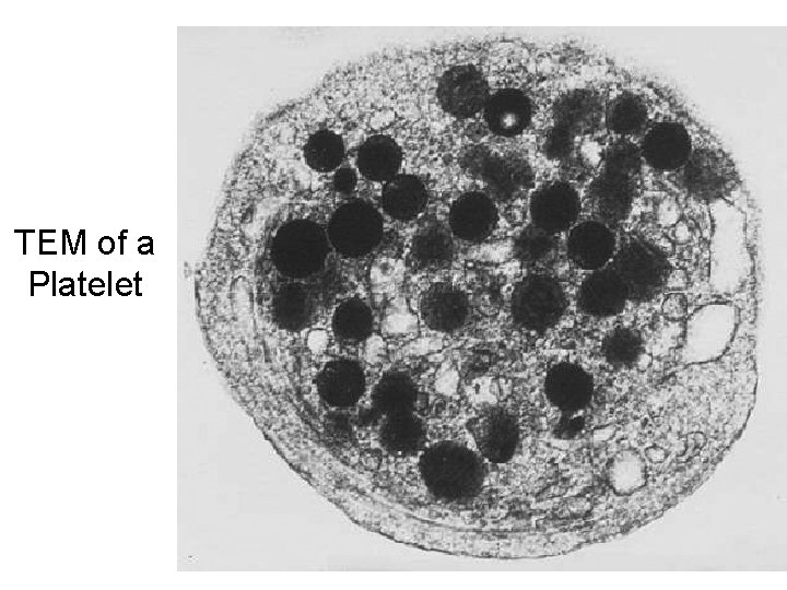 TEM of a Platelet 