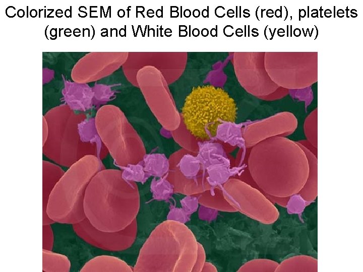 Colorized SEM of Red Blood Cells (red), platelets (green) and White Blood Cells (yellow)